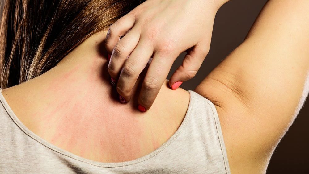 Dermatitis por el uso de cosmeticos